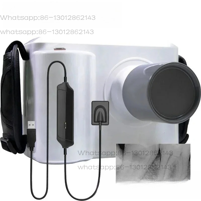 Full Set Portable Dental X ray - Veterinary X-Ray recensione e prezzo